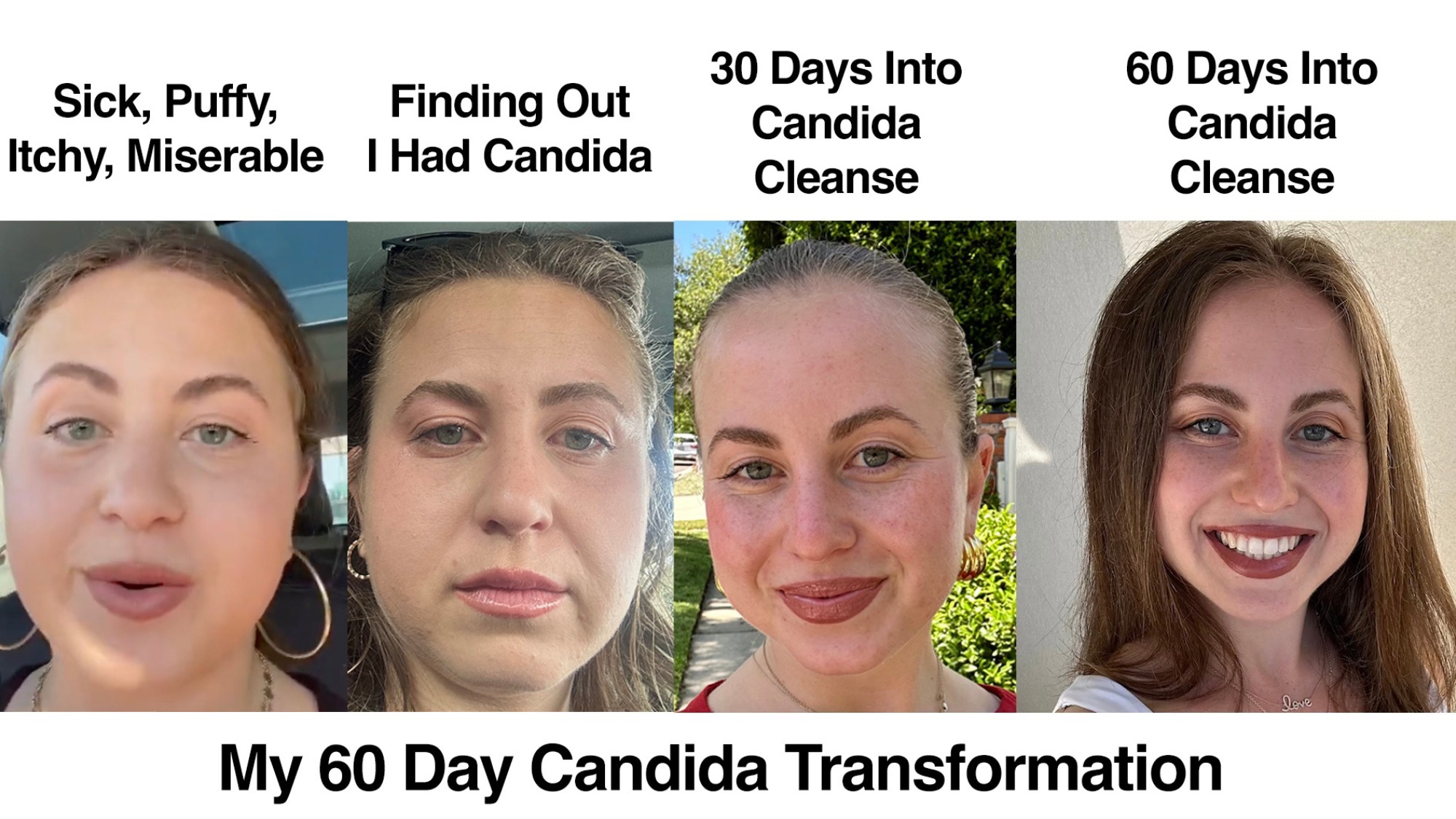 Candida Community