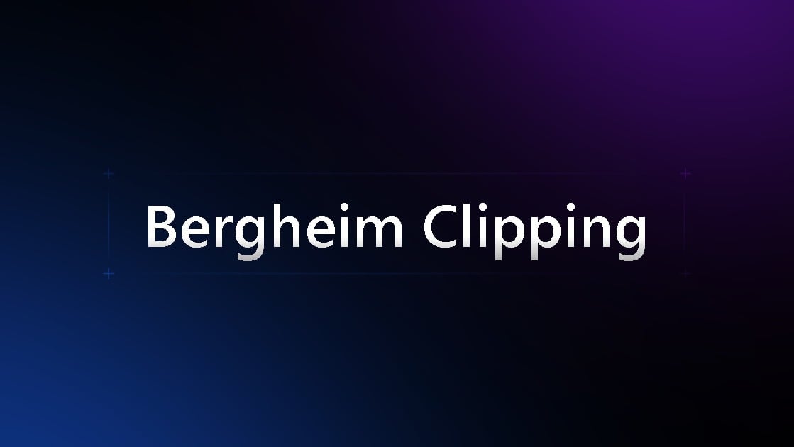 Bergheim AI Clipping agency