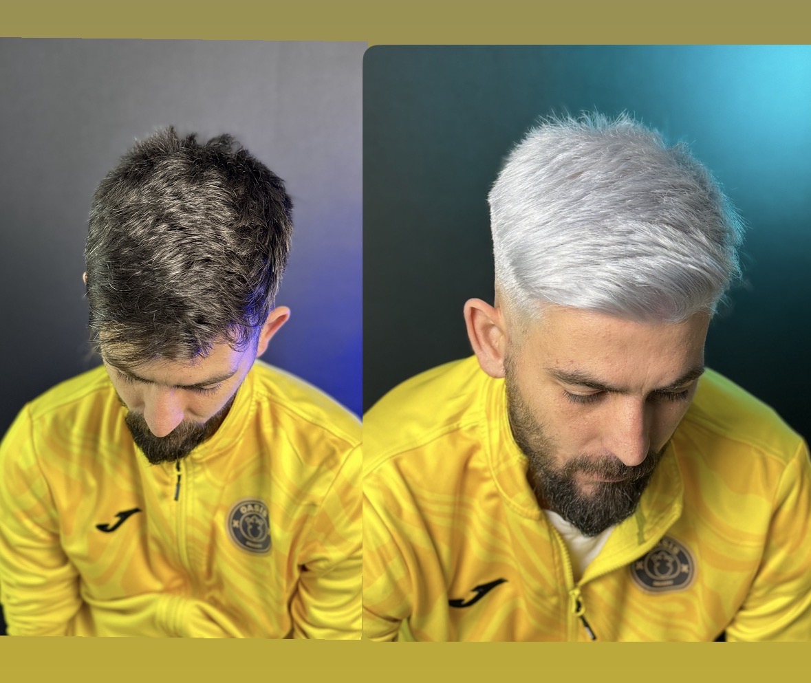 WHITE HAIR 
