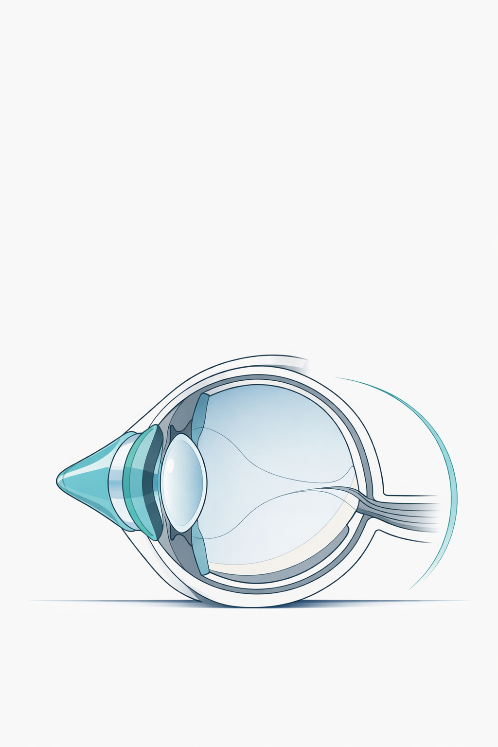Keratoconus Surgical Decision Kit - Make a Clearer Next-Step Plan