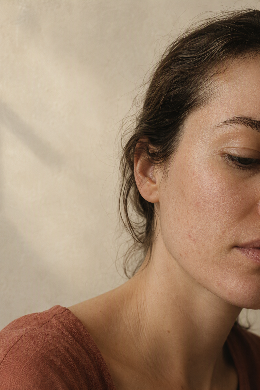 Care for Hormonal Acne Without Stripping Your Skin Barrier