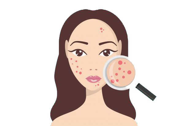 The 72-Hour Acne Routine Reset