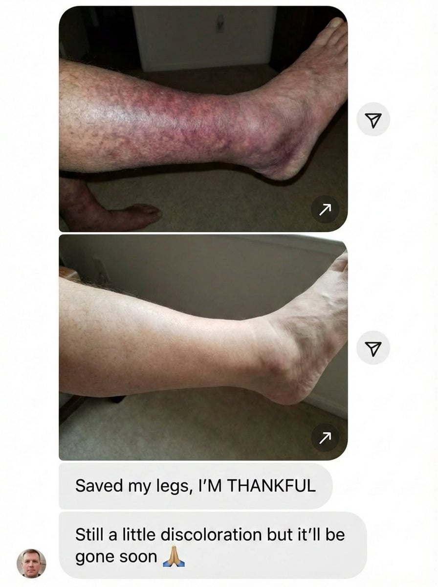 Circulation transformation results
