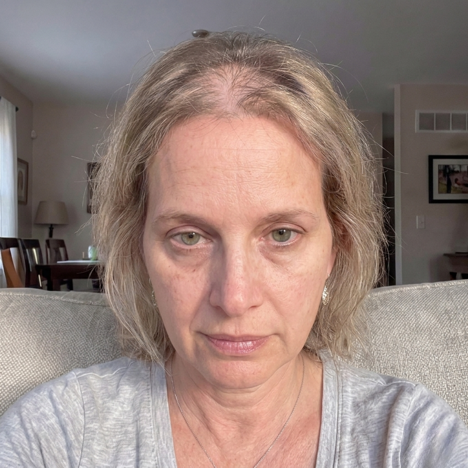 A close-up of a woman with short, blonde, thinning hair looking at the camera with a neutral expression.