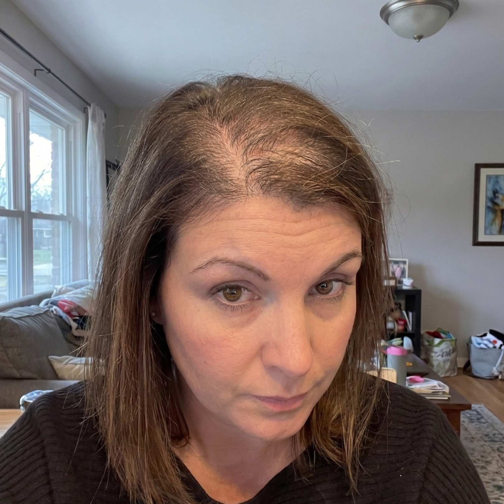 A woman with thinning brown hair at her scalp, looking at the camera indoors.