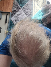 Month 3