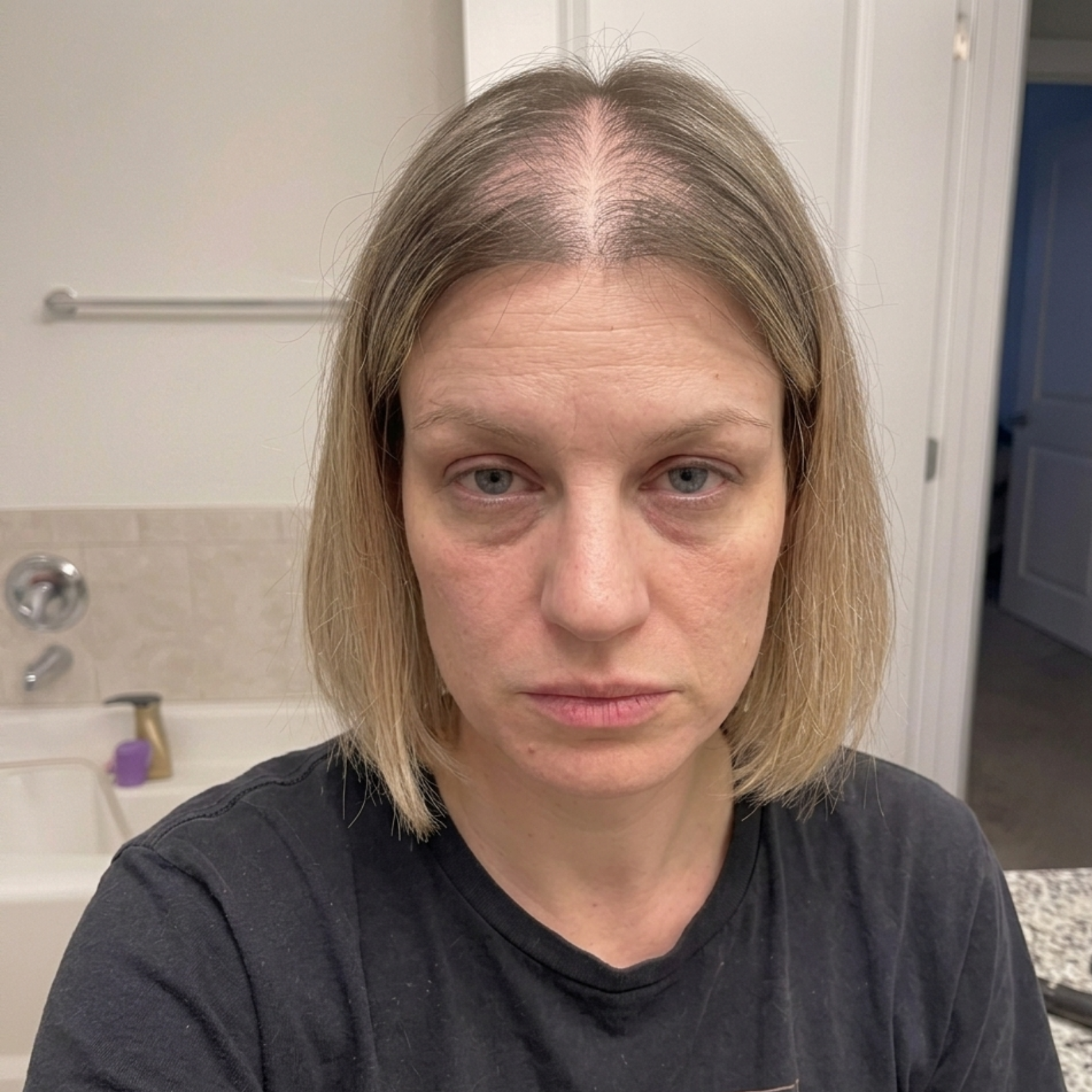 A woman with thinning blonde hair parted in the center looks directly at the camera in a bathroom.