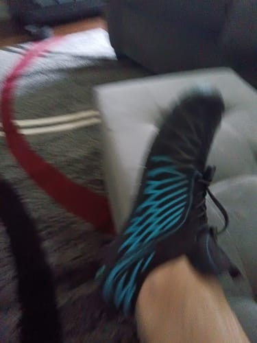 Customer photo review of Peak - Bunion Corrector