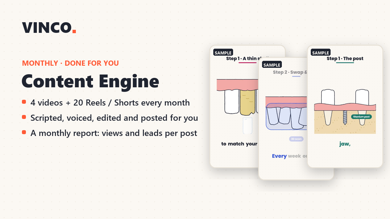 Content Engine (done-for-you monthly content)
