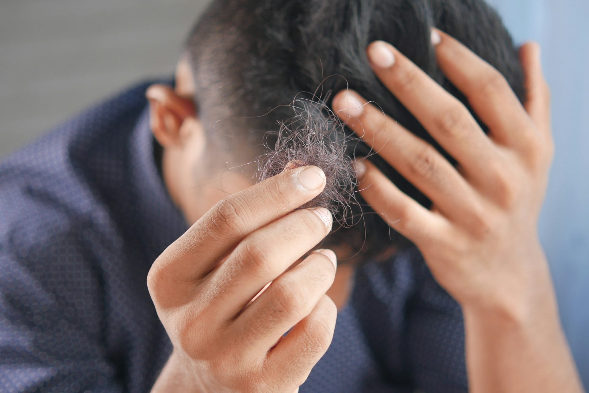 The Hair Recovery Protocol