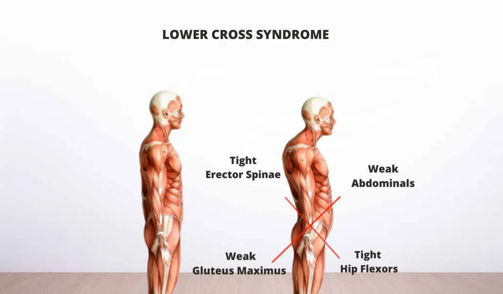 Desk Worker Back Pain Reset — 28 Days