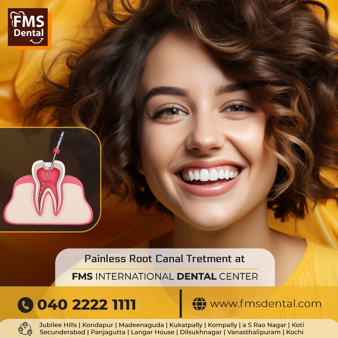 Root Canal Treatment