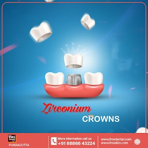 Zirconia Crowns