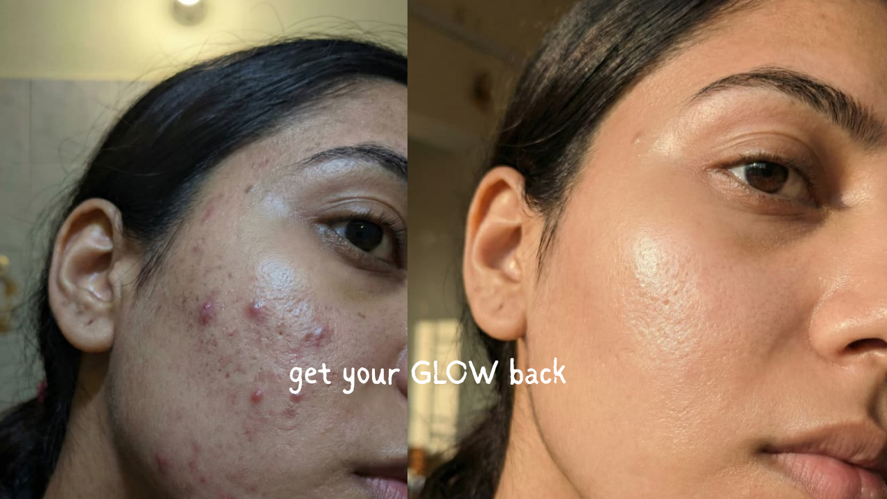 Get Glowing Skin At Home