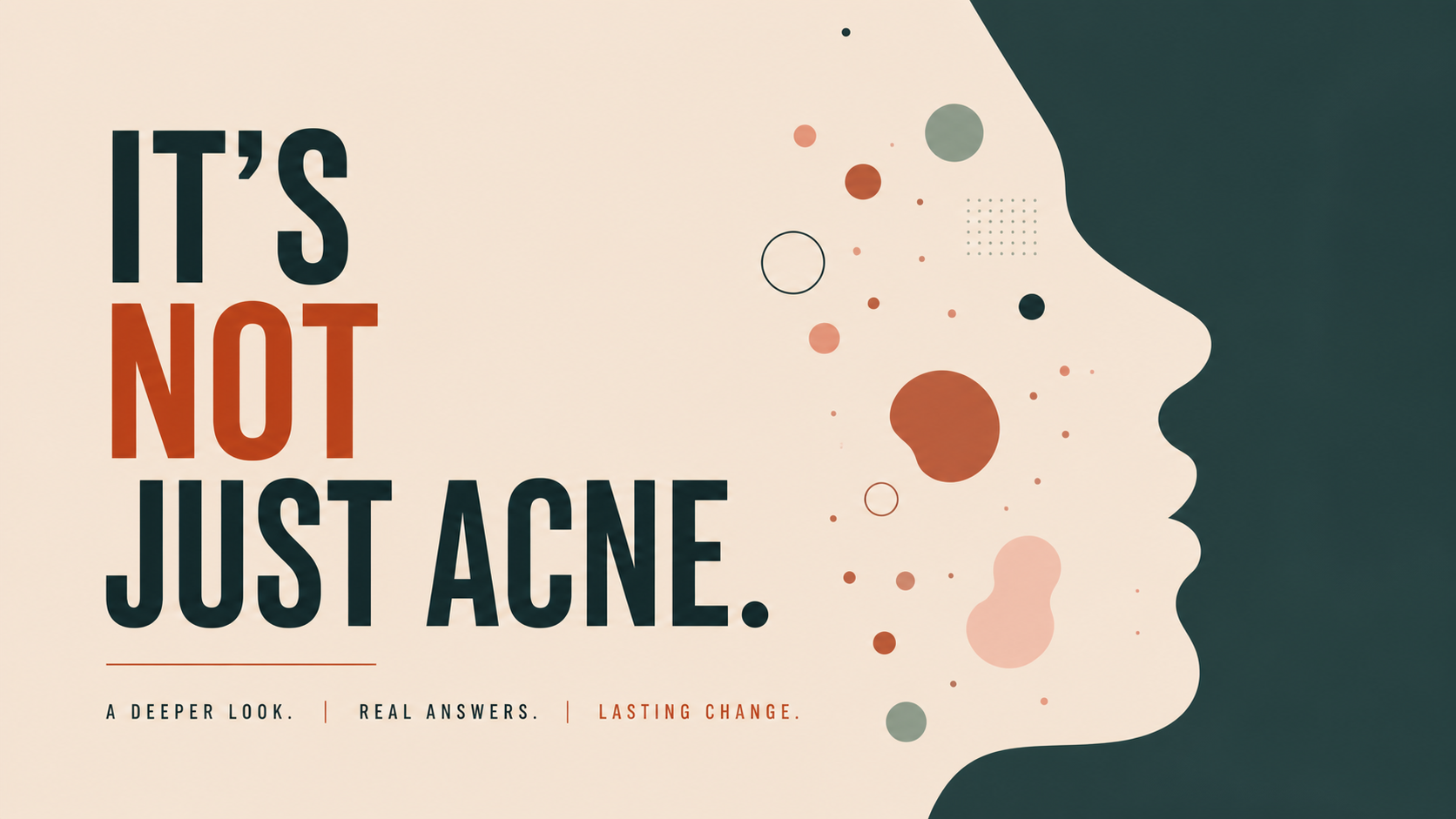It’s Not Just Acne