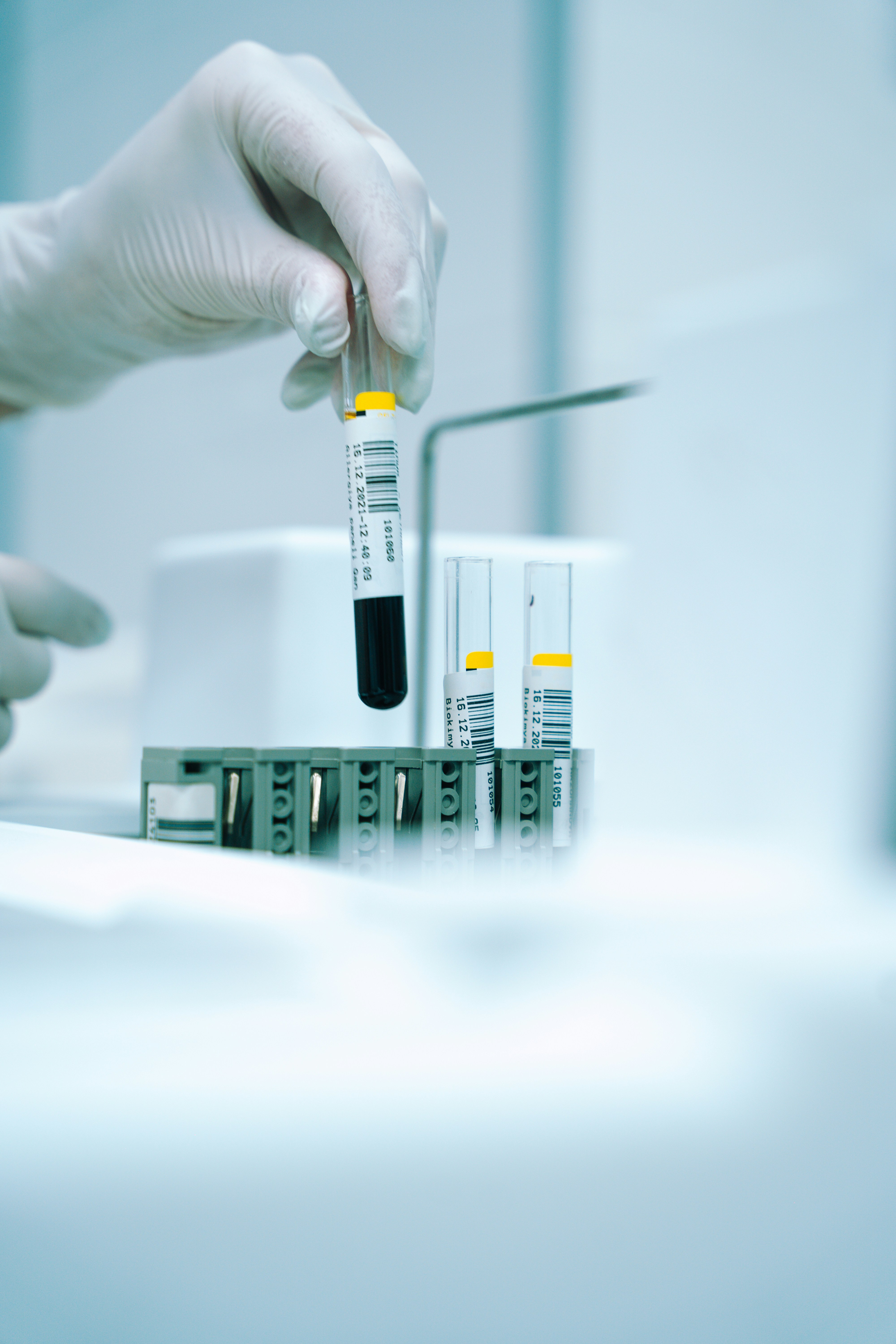 Gut Iron and Ferritin Recovery