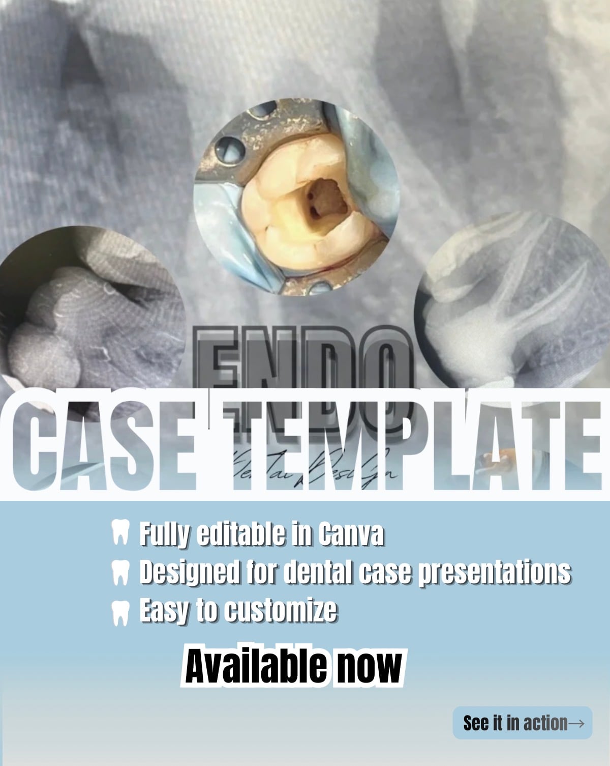 Endodontic Case Templete 