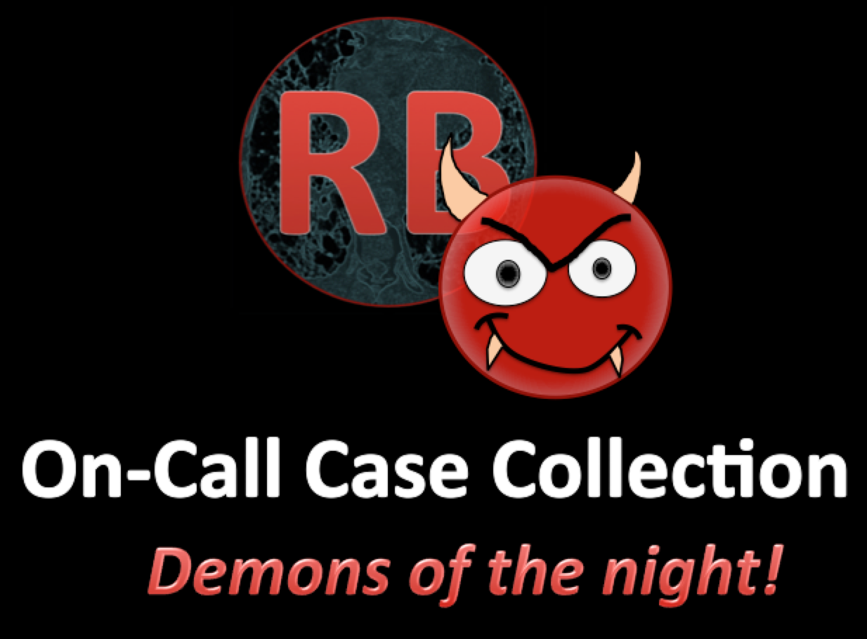 Demons of the Night: Oncall Case Collection
