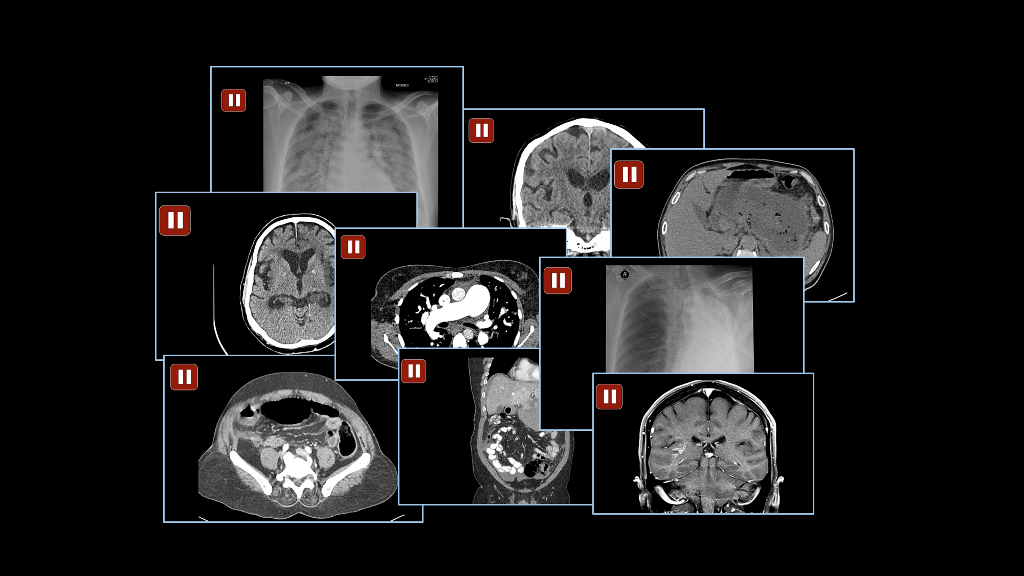 Demons of the Night: Oncall Case Collection