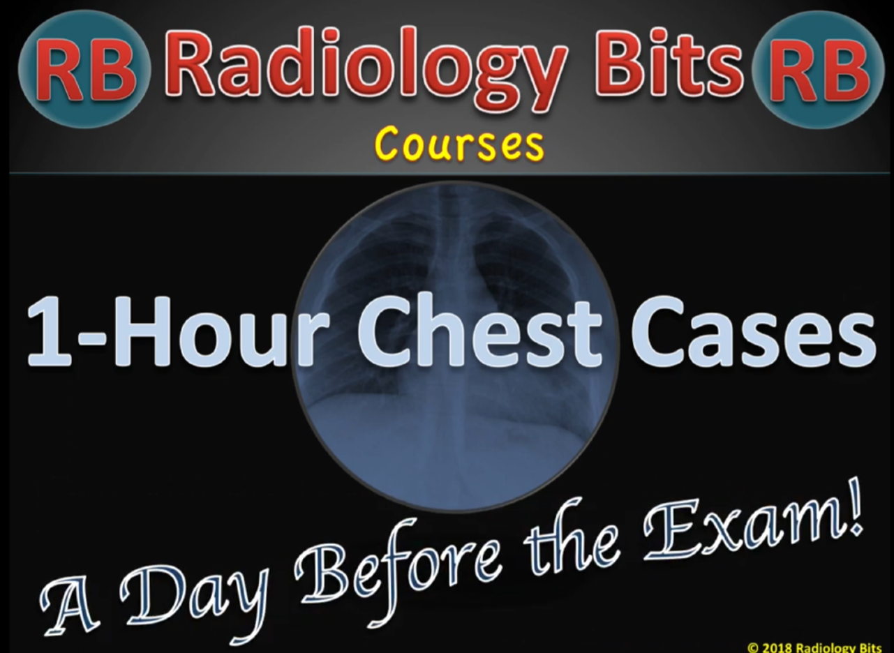 1-Hour Chest Cases: Take it Like an Exam