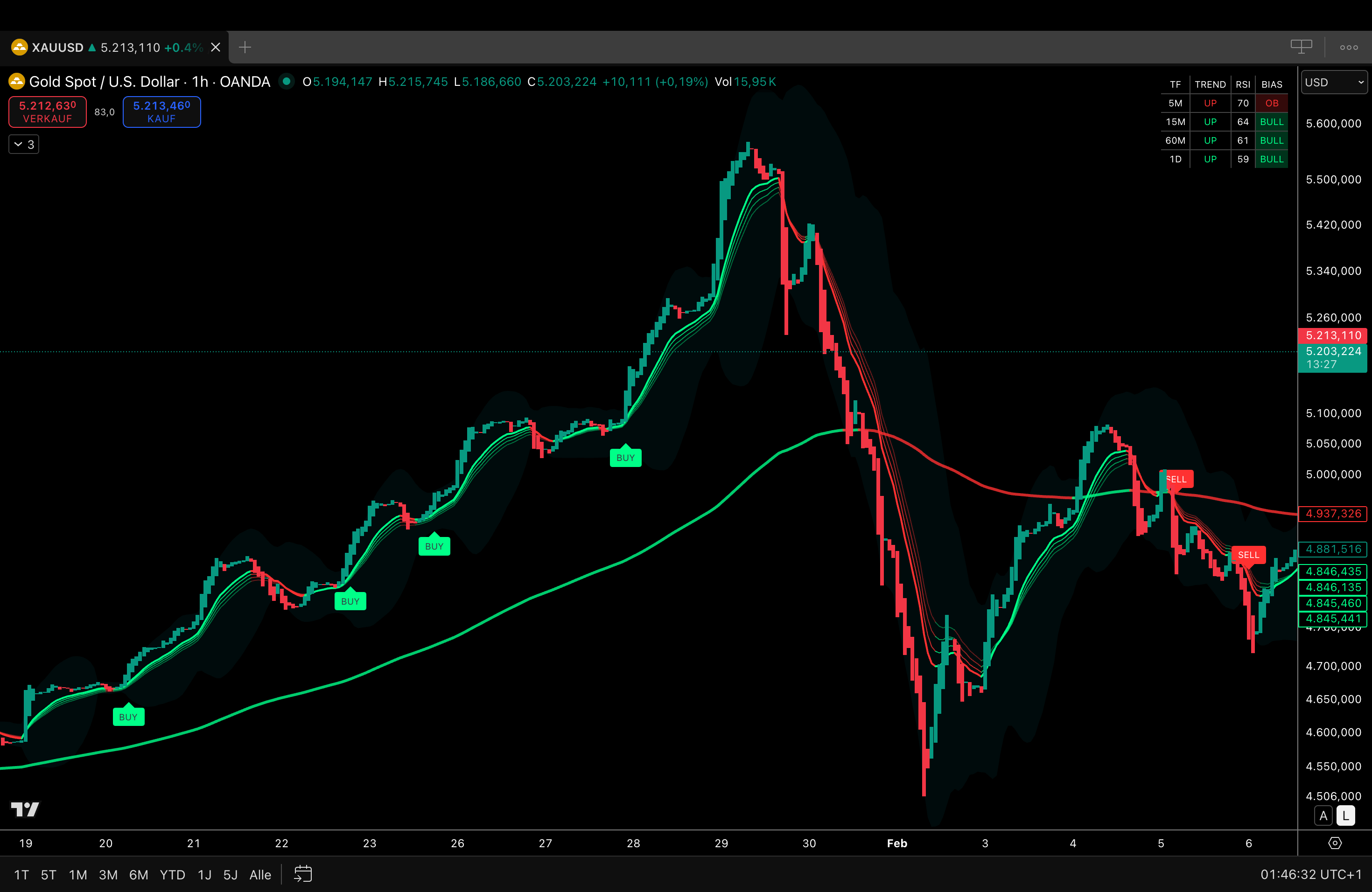 Axonalgo Indicator 